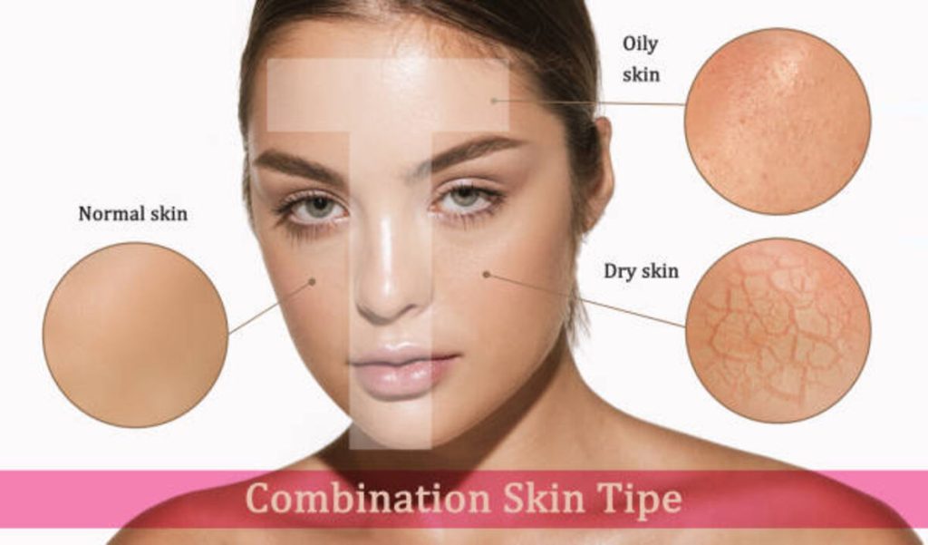 Oily Skin